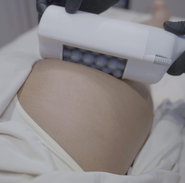 Body Contouring